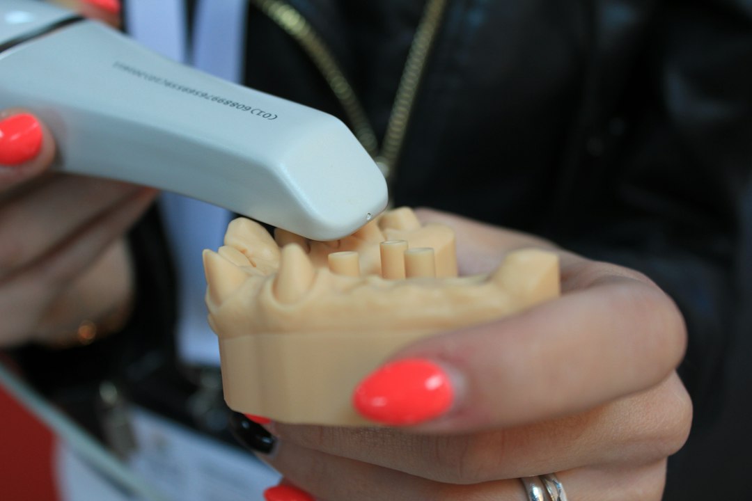 Scanning a stone model with an intraoral scanner