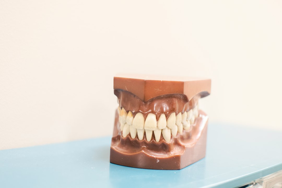 Complete upper and lower denture on a light background