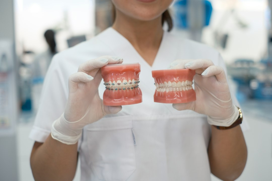 New Same-Week Veneer and Denture Service from Our Charlotte Lab