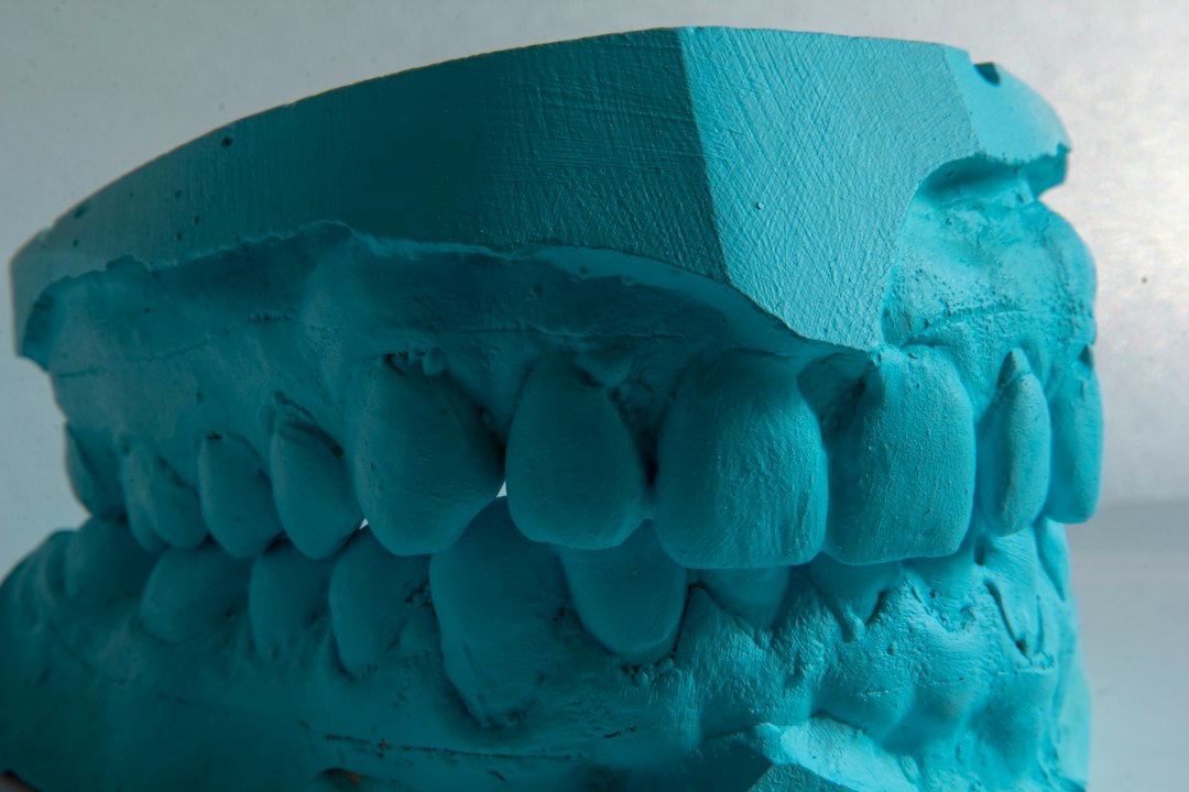 Blue stone model of the upper and lower arches