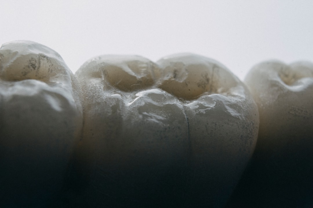 Close-up of ceramic crown surfaces