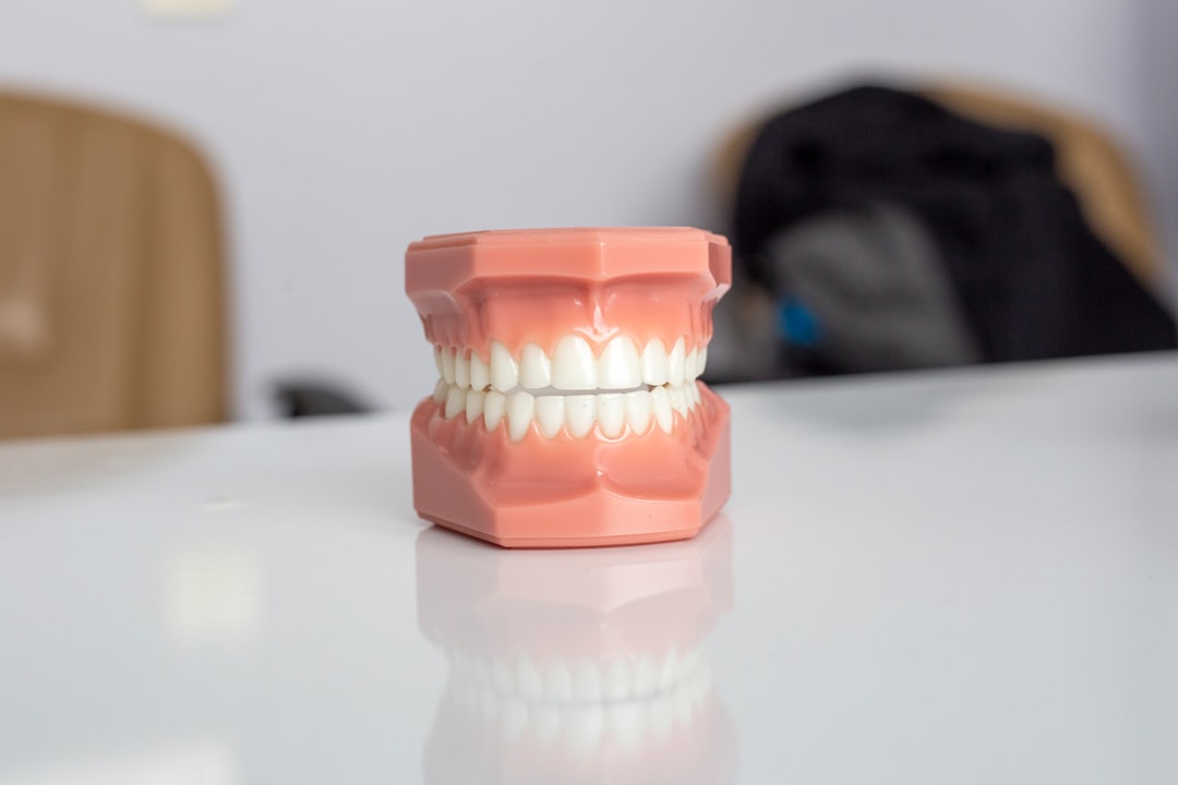 Full denture model on a white counter
