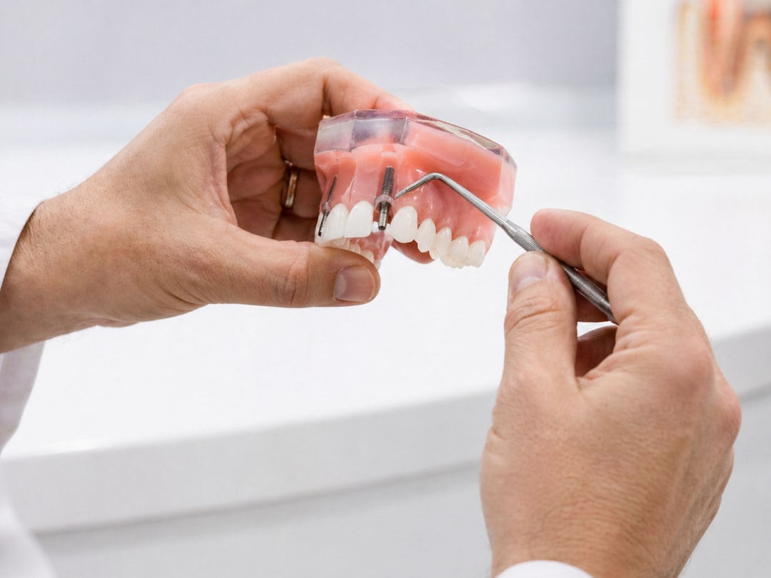 Clinician pointing to an implant on a full-arch model