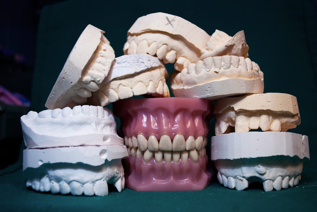 Stone models and a finished denture stacked on the bench