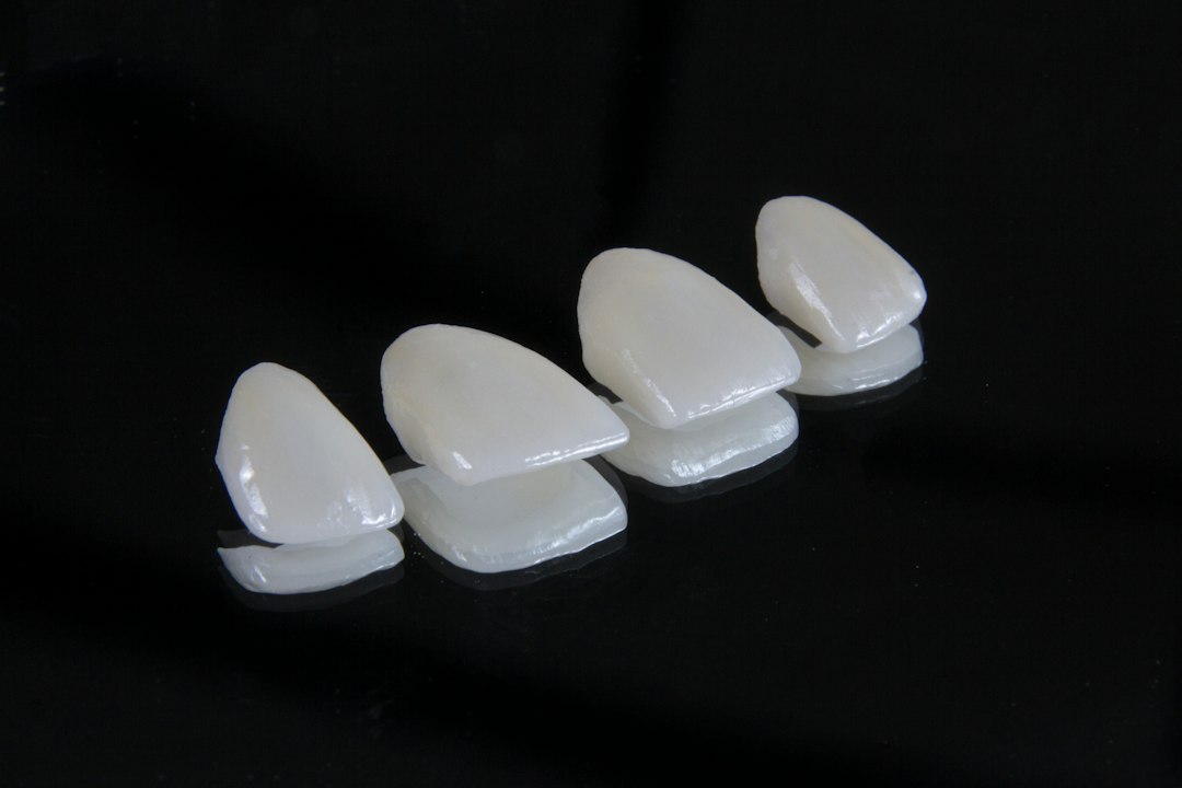 Four porcelain veneers on a black background