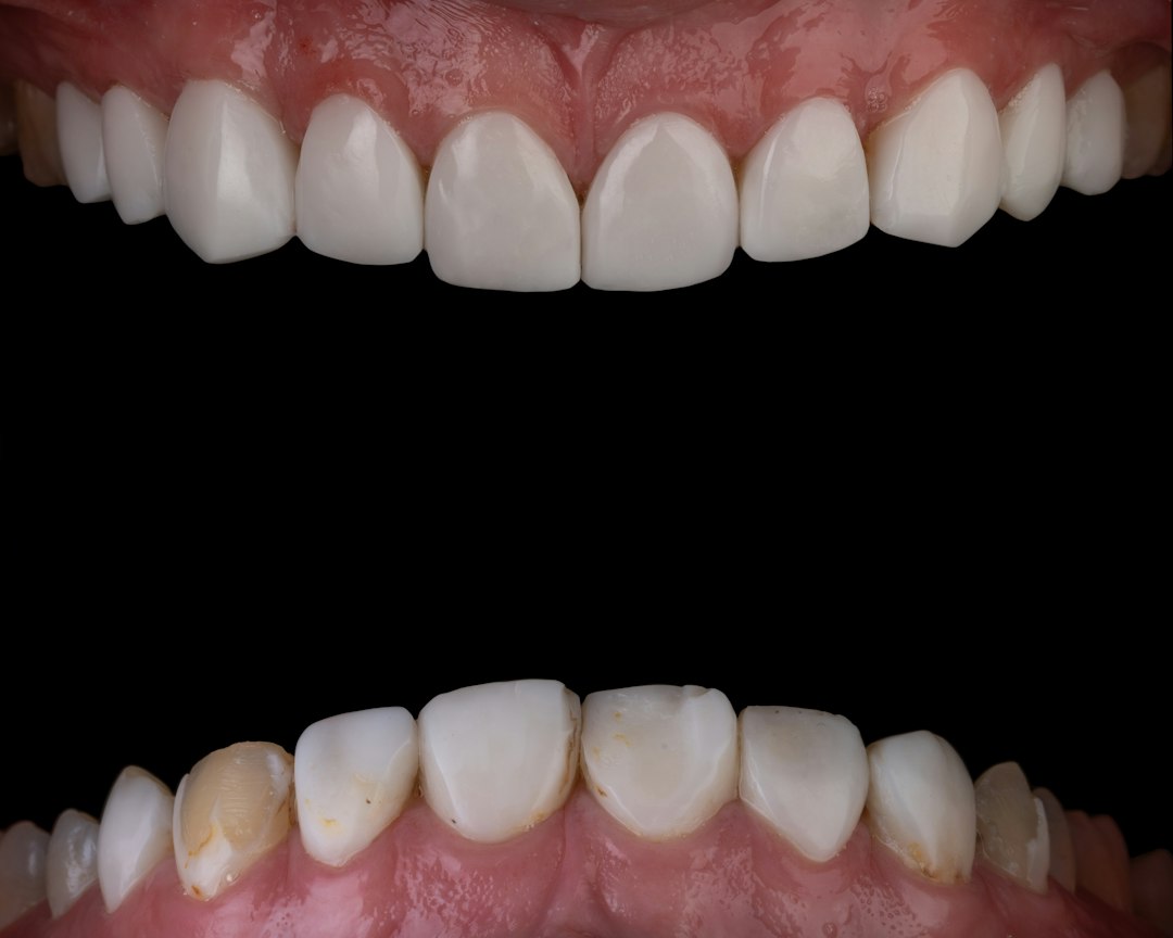 Close-up of a finished set of anterior restorations