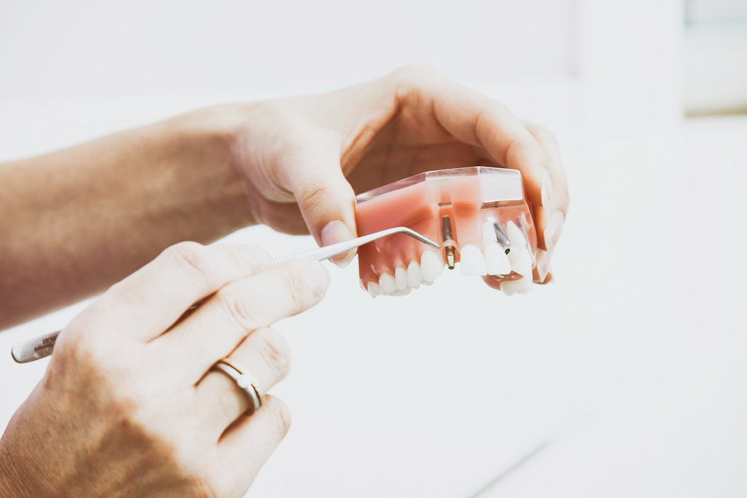 Hands holding an implant-supported prosthesis model